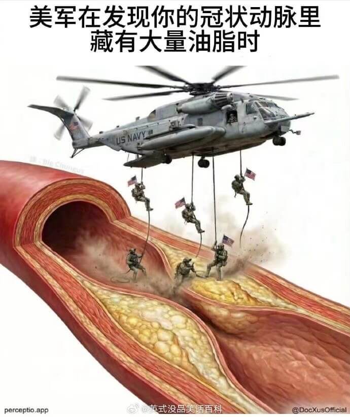 美军在发现你的冠状动脉里藏有大量油脂时ISNAVpercep