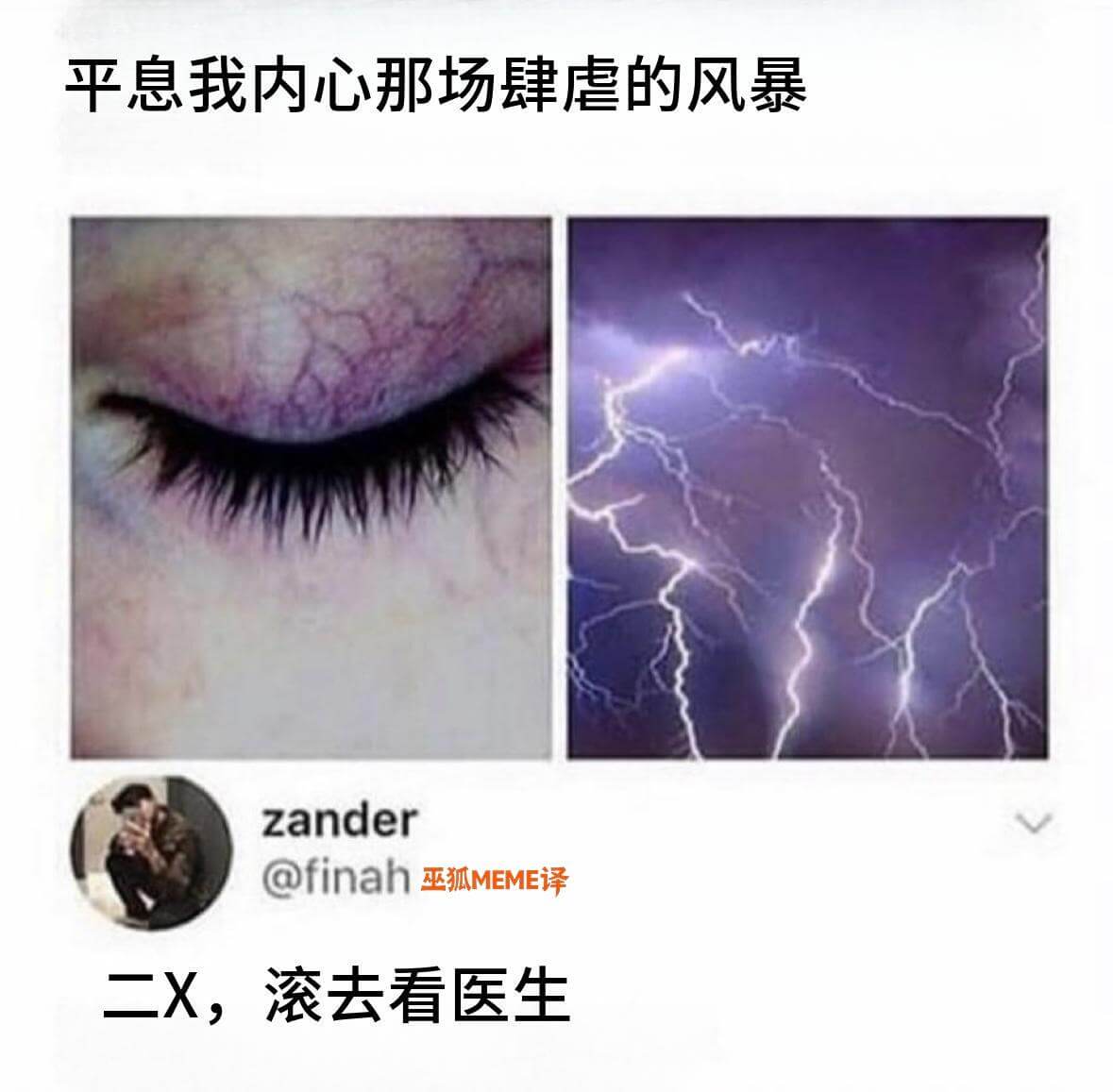平息我内心那场肆虐的风暴Zander@Finah巫狐MEME