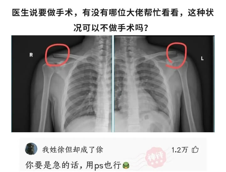 医生说要做手术，有没有哪位大佬帮忙看看，这种状况可以不做手术