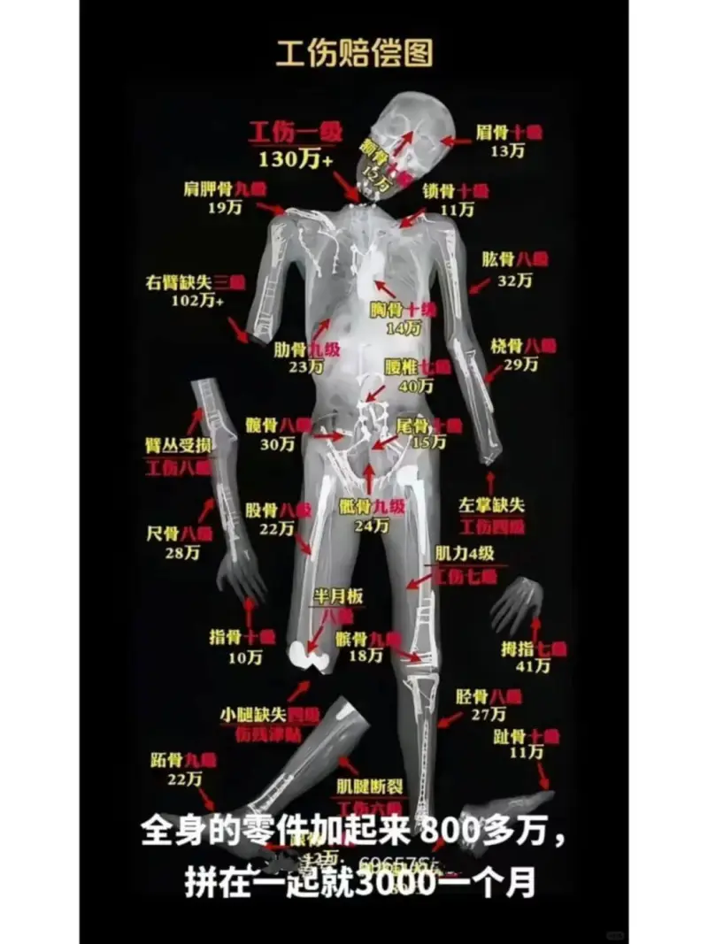 工伤赔偿图工伤一级眉骨十130万+13万肩脚骨九显锁骨十锅1