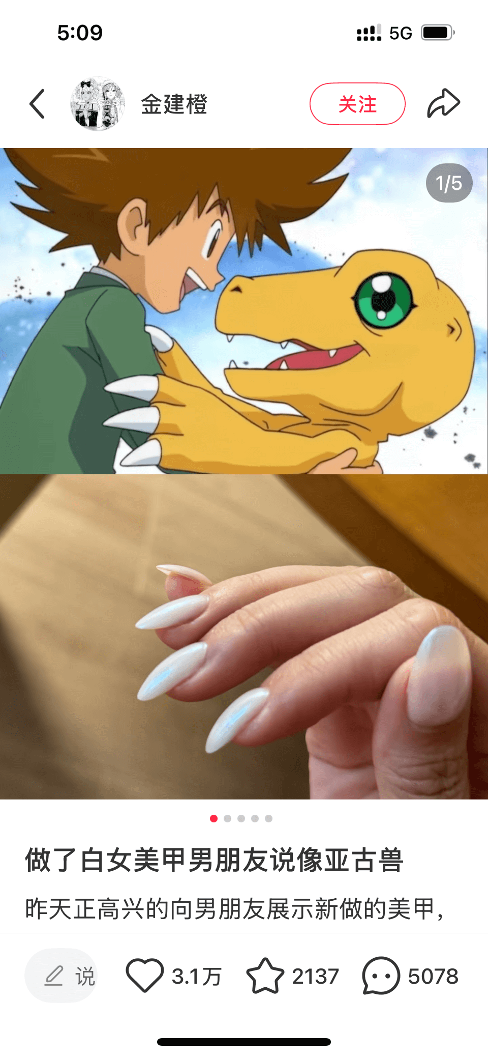 5:09:!5G金建橙关注1/5做了白女美甲男朋友说像亚古兽