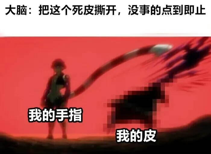 大脑：把这个死皮撕开，没事的，点到即止。我的手指，我的皮。