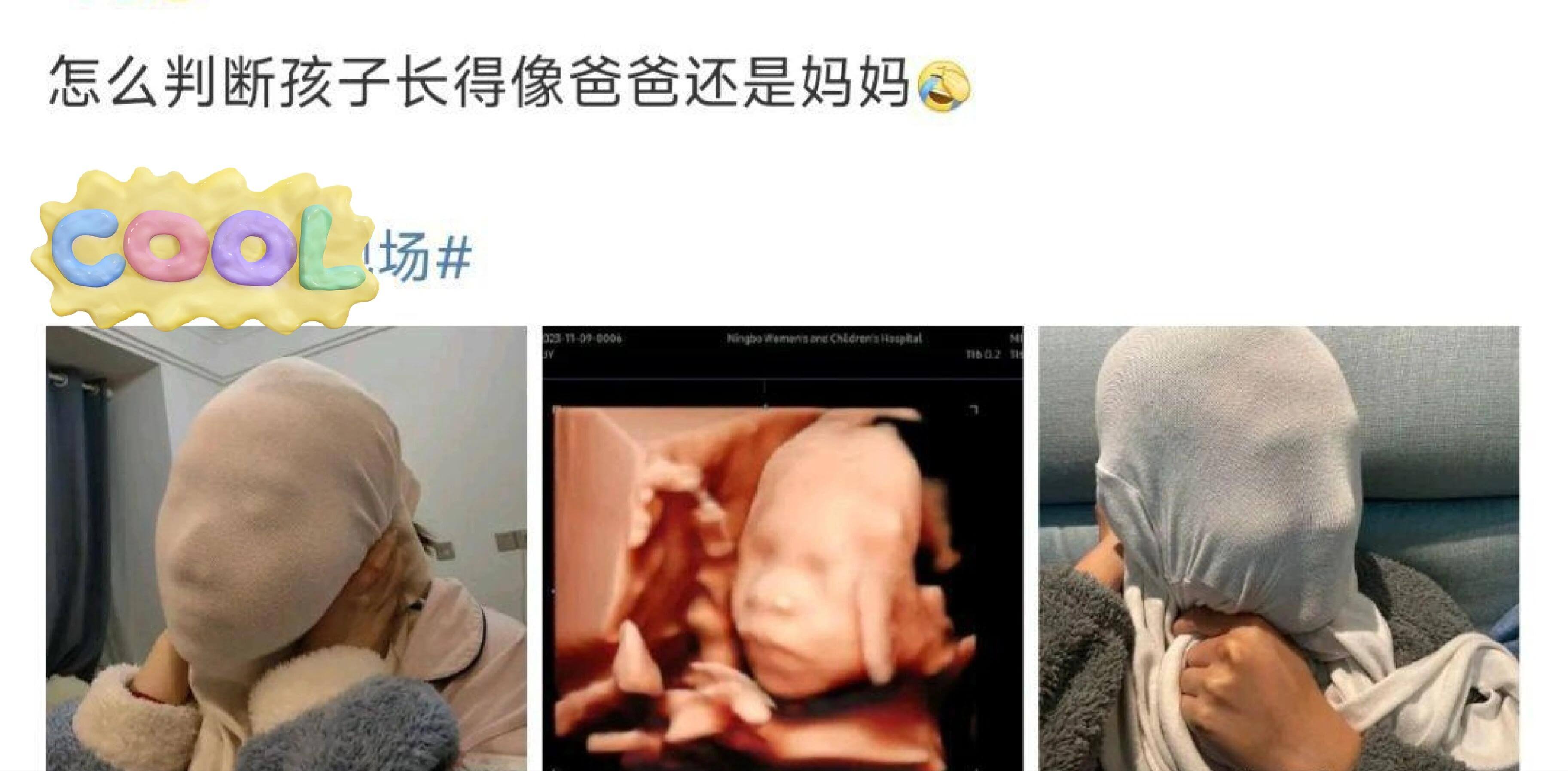 怎么判断孩子长得像爸爸还是妈妈要判断孩子长得像爸爸还是妈妈，
