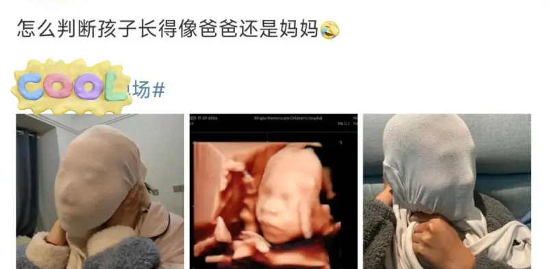 怎么判断孩子长得像爸爸还是妈妈要判断孩子长得像爸爸还是妈妈，
