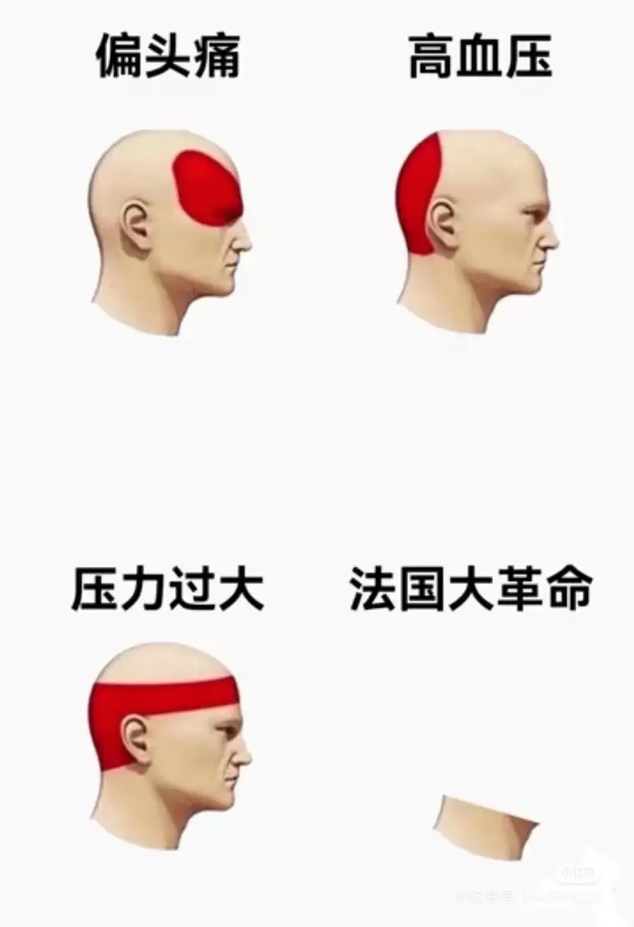 偏头痛高血压压力过大法国大革命