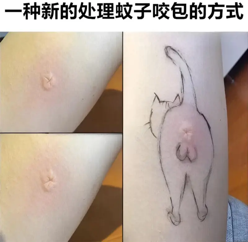 一种新的处理蚊子咬包的方式