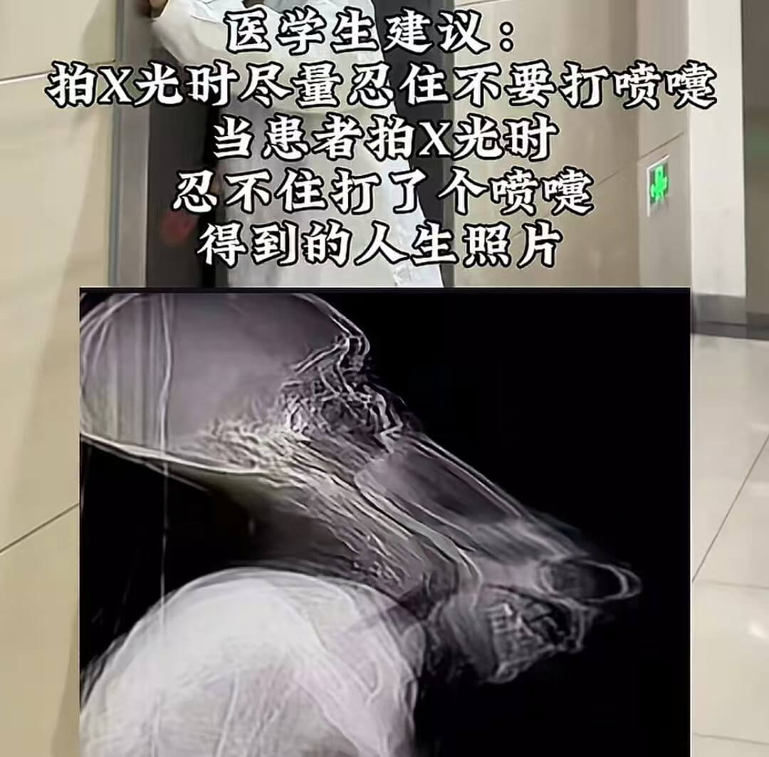 医学生建议：拍X光时尽量忍住不要打喷嚏当患者拍X光忍不住打了