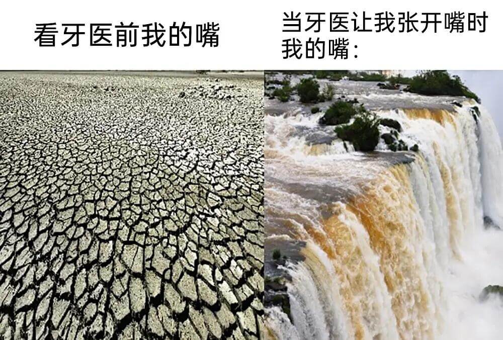 当牙医让我张开嘴时我的嘴：看牙医前我的嘴