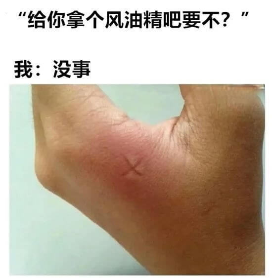 “给你拿个风油精吧要不？”我：没事