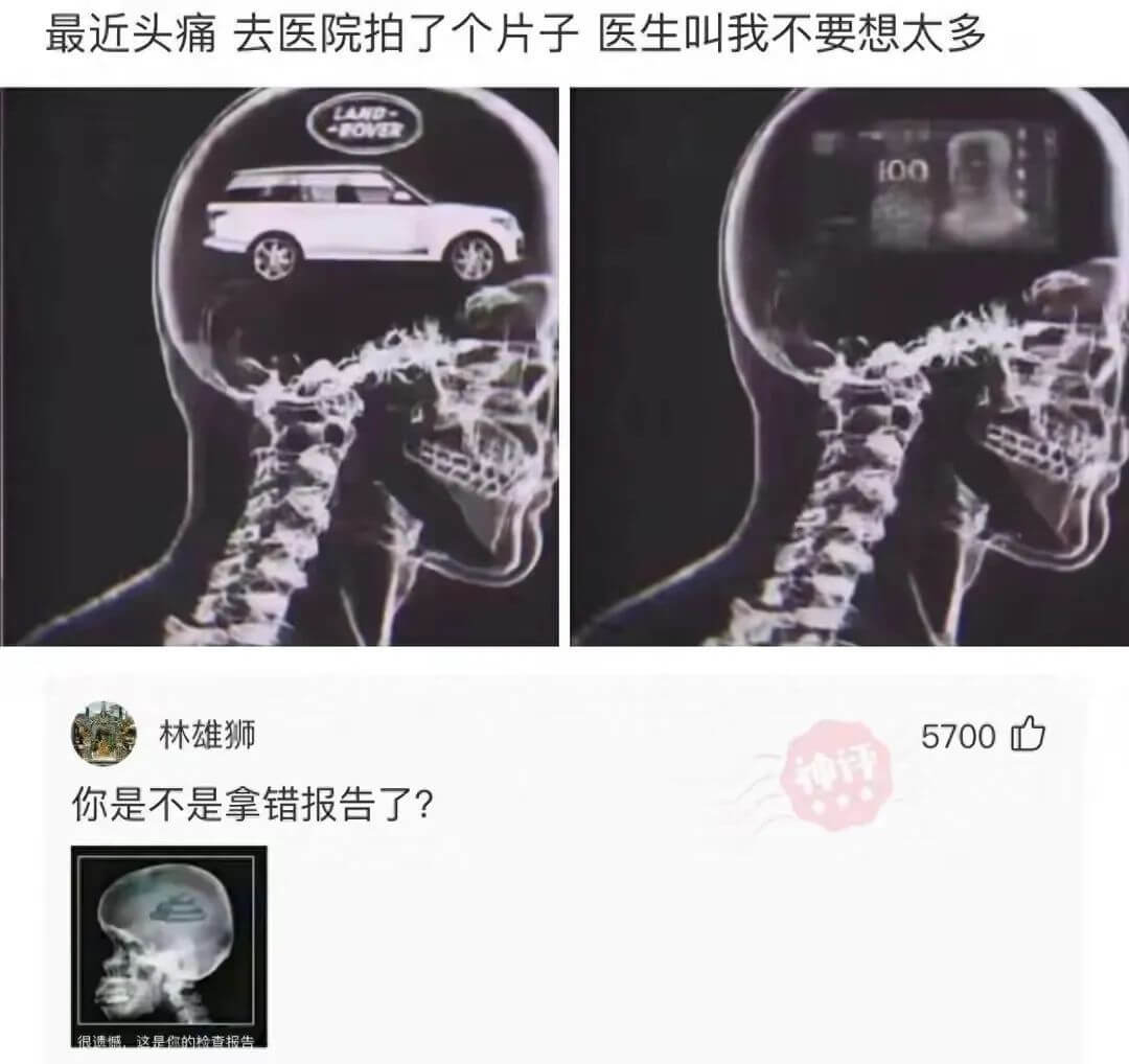 最近头痛去医院拍了个片子，医生叫我不要想太多。LAND-FO