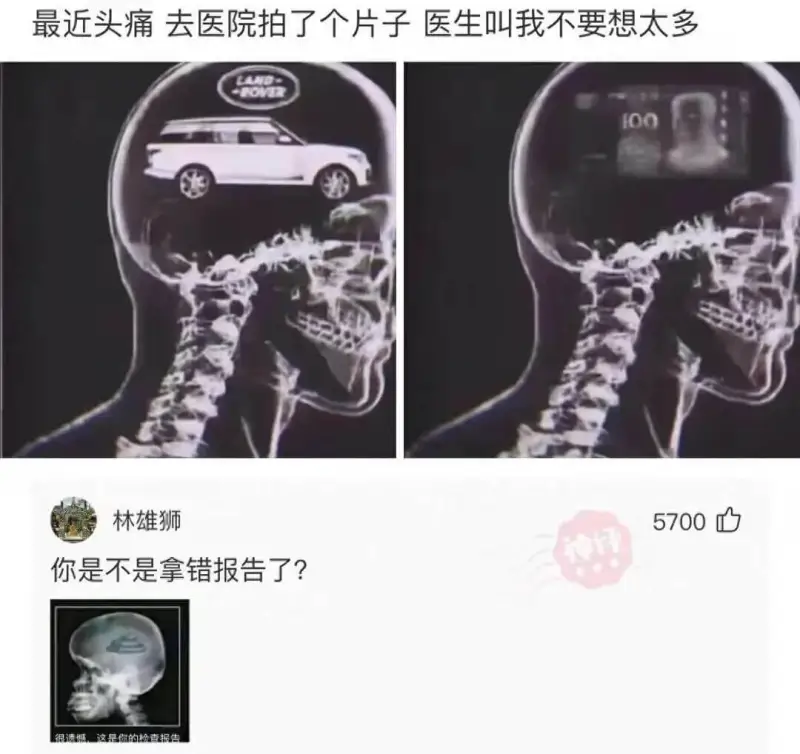 最近头痛去医院拍了个片子，医生叫我不要想太多。LAND-FO