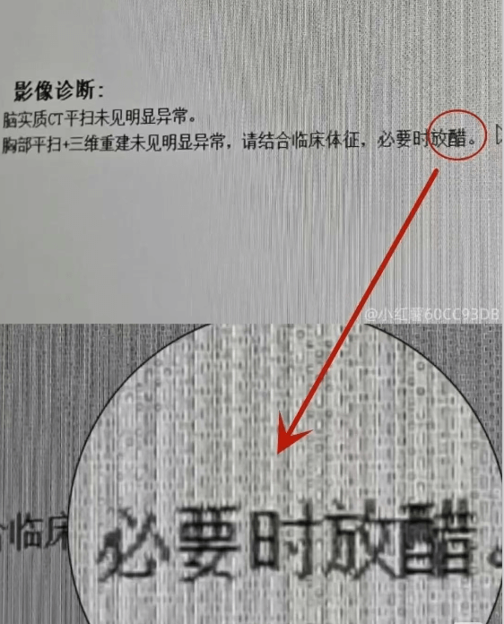 影像诊断：脑实质CT平扫未见明显异常。胸部平扫+三维重建未见