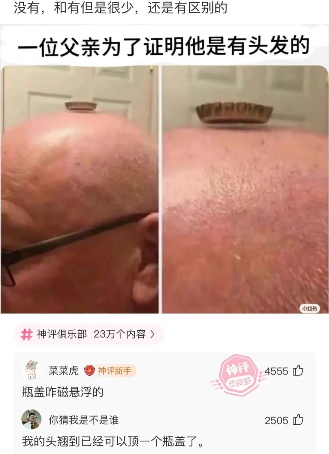 没有，和有但是很少，还是有区别的一位父亲为了证明他是有头发的