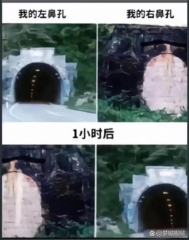 我的左鼻孔我的右鼻孔1小时后爸@梦哒啦哒