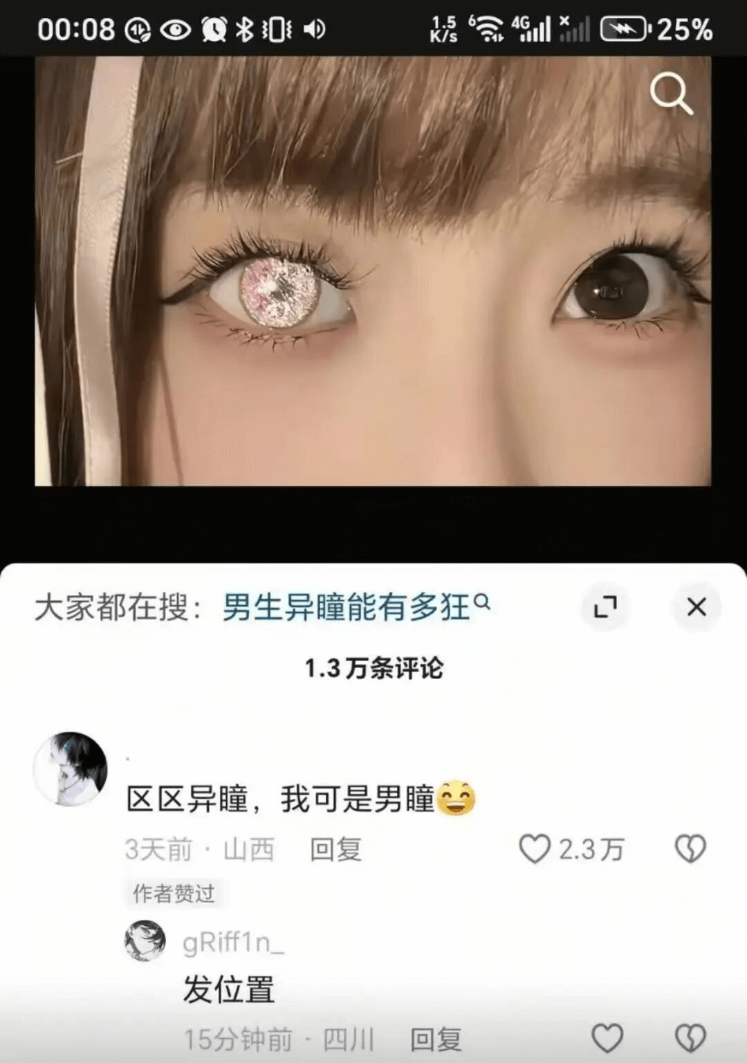 00:080Q*0k4G?·25%大家都在搜：男生异瞳能有多