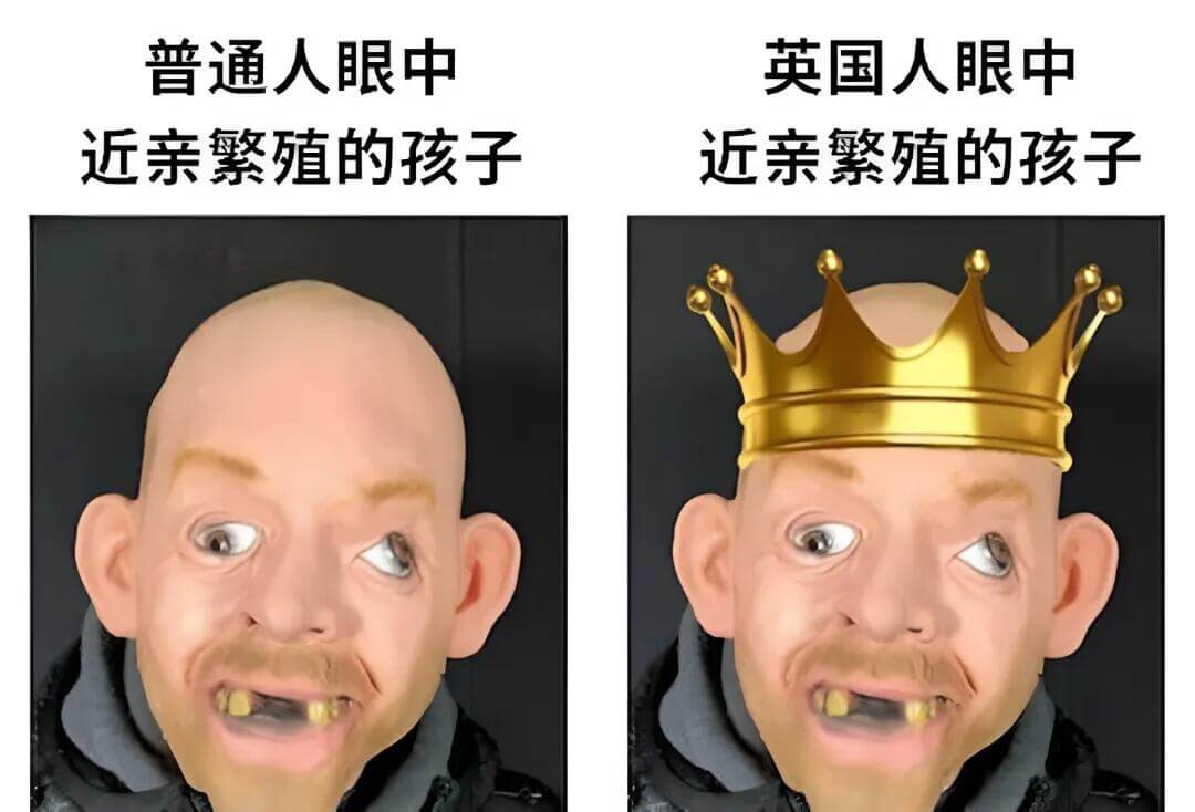 普通人眼中英国人眼中近亲繁殖的孩子近亲繁殖的孩子