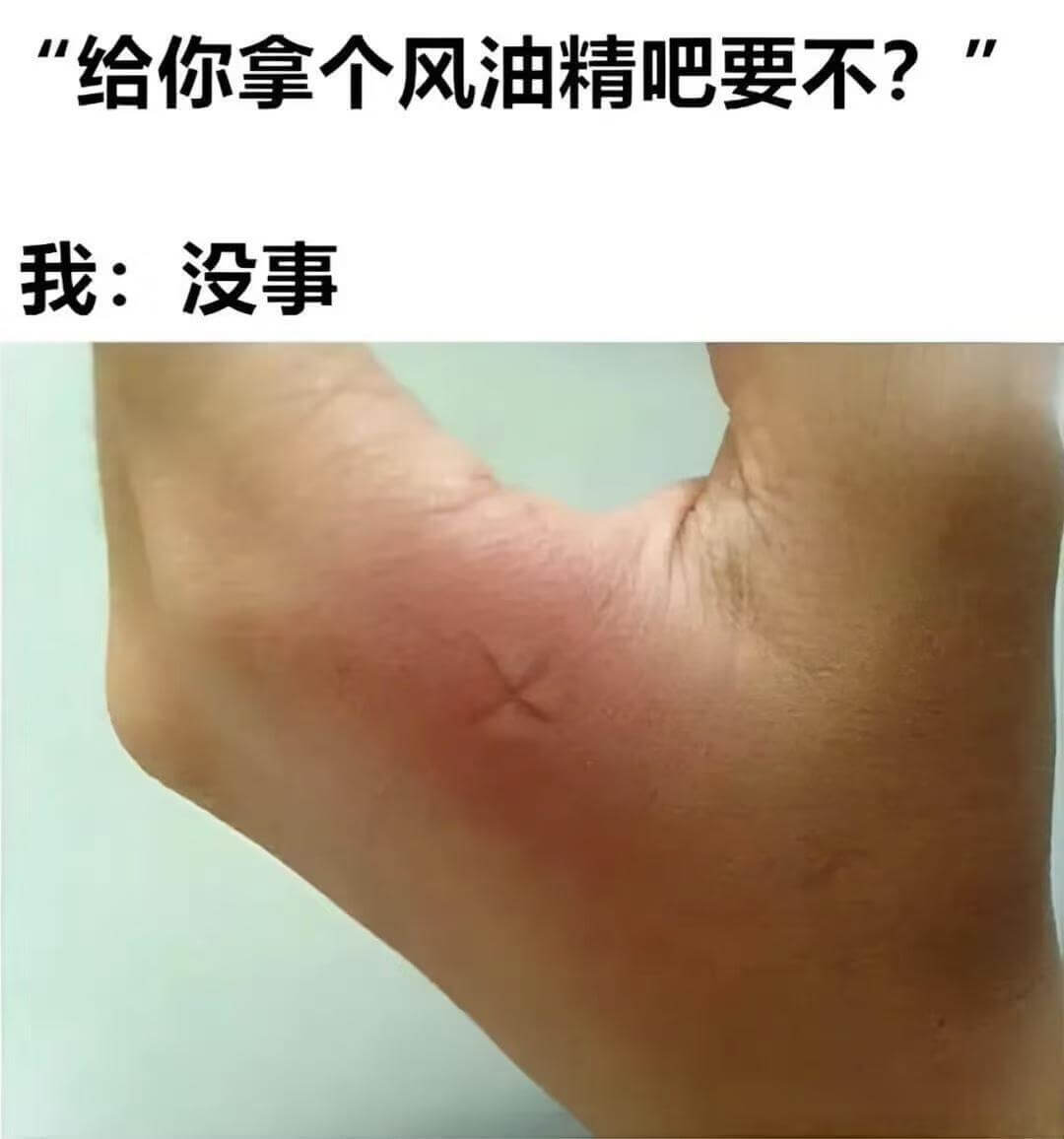 “给你拿个风油精吧要不？我：没事”