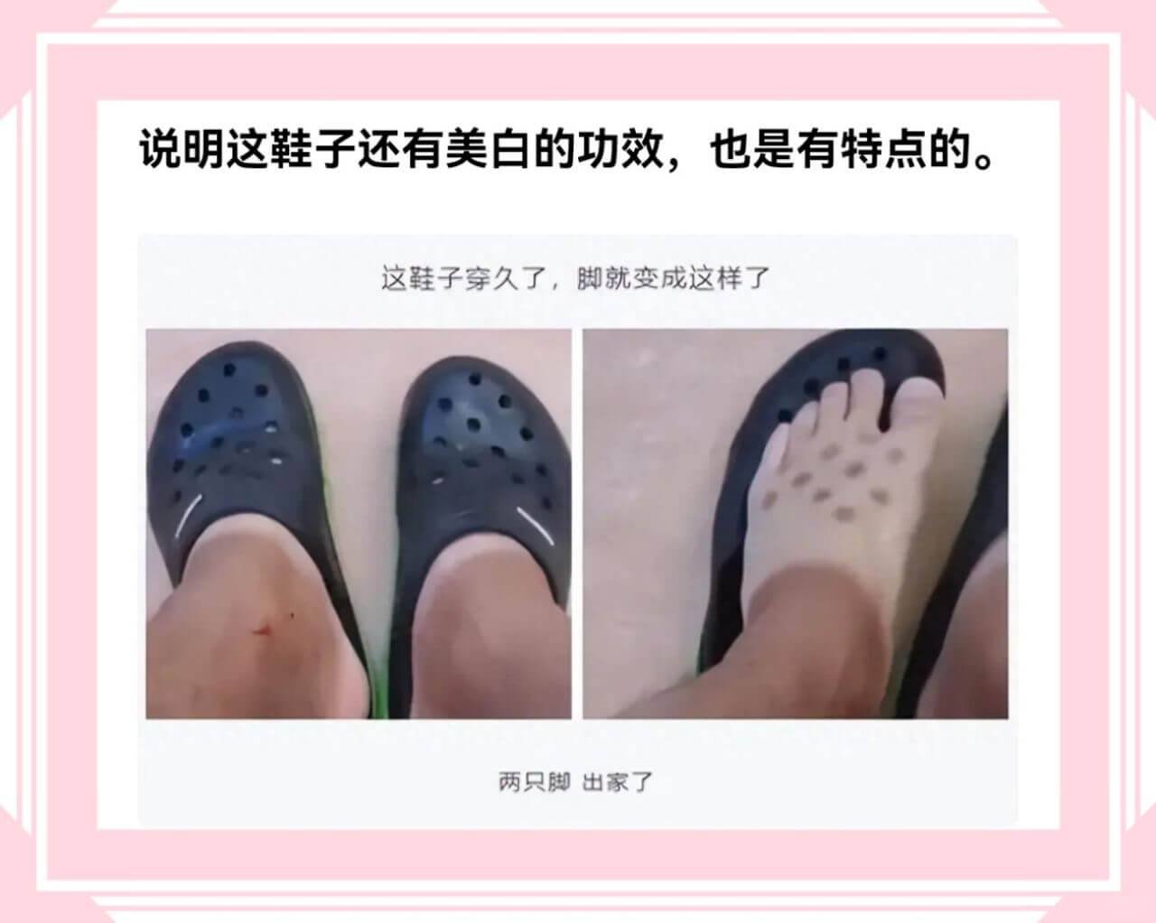 说明这鞋子还有美白的功效，也是有特点的。这鞋子穿久了，脚就变