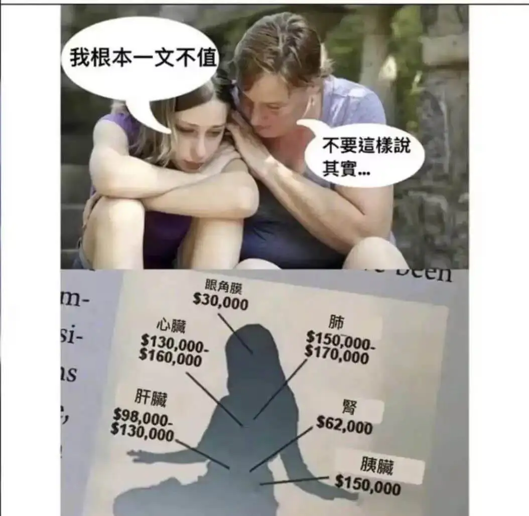 我根本一文不值不要這樣說其實…m-si-s眼角膜$30,00