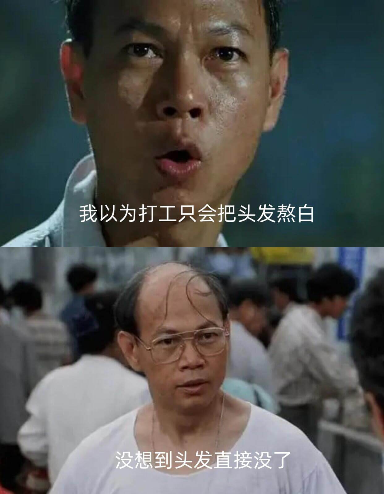 我以为打工只会把头发熬白没想到头发直接没了