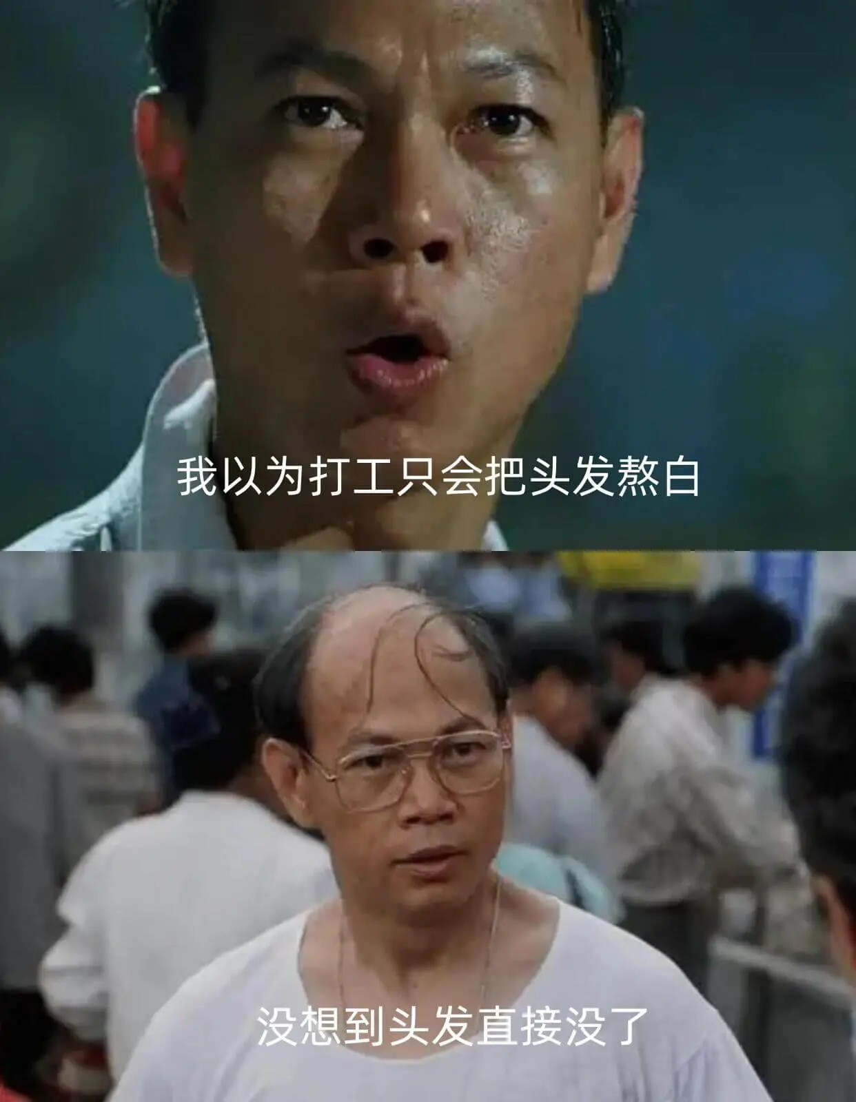 我以为打工只会把头发熬白没想到头发直接没了