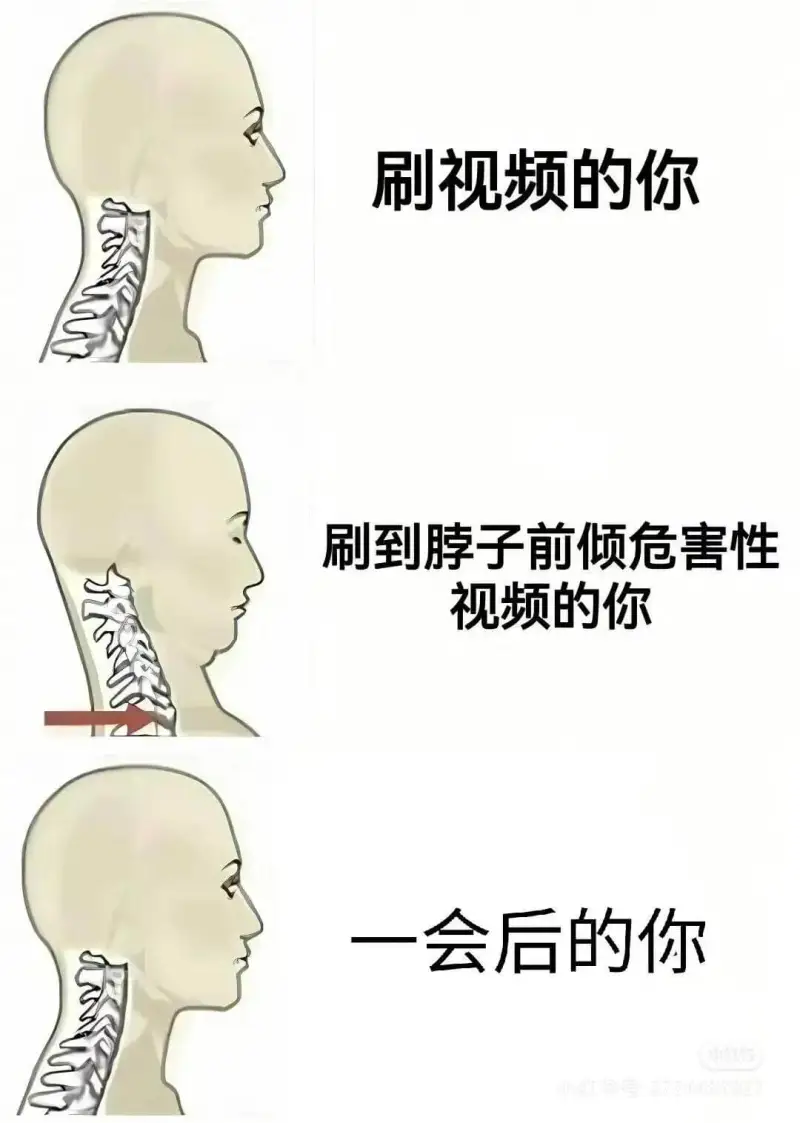 刷视频的你刷到脖子前倾危害性视频的你一会后的你
