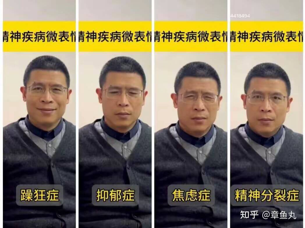 1418491神疾病微表情神疾病微表情神疾病微表情神疾病微表