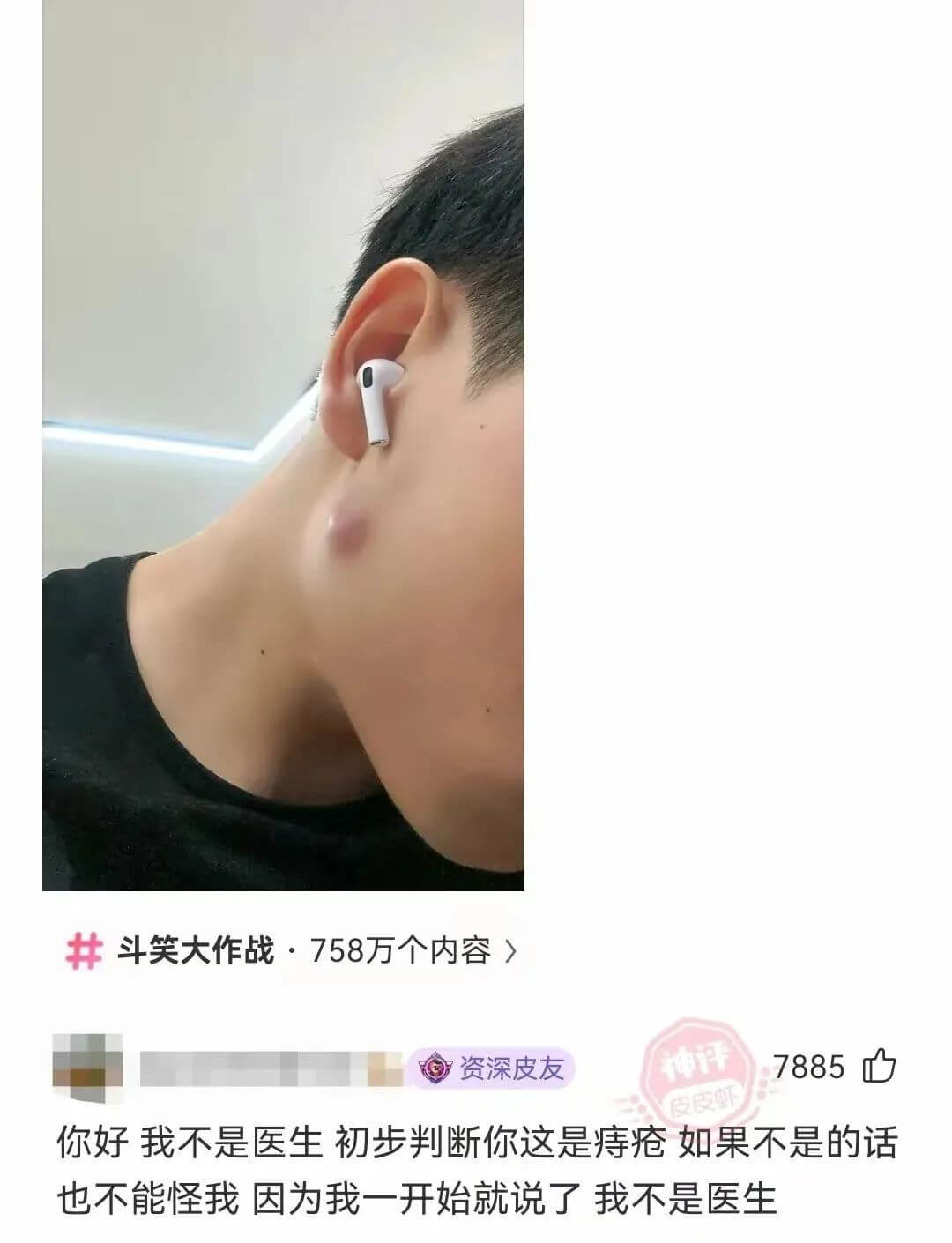 斗笑大作战：758万个内容）资深皮友神评7885皮皮虾你好我