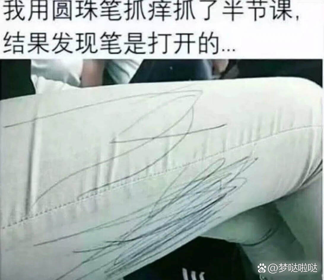 我用圆珠笔抓痒抓了半节课结果发现笔是打开的@梦哒啦哒