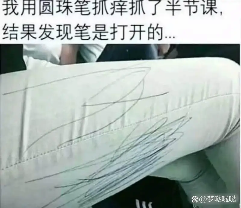 我用圆珠笔抓痒抓了半节课结果发现笔是打开的@梦哒啦哒