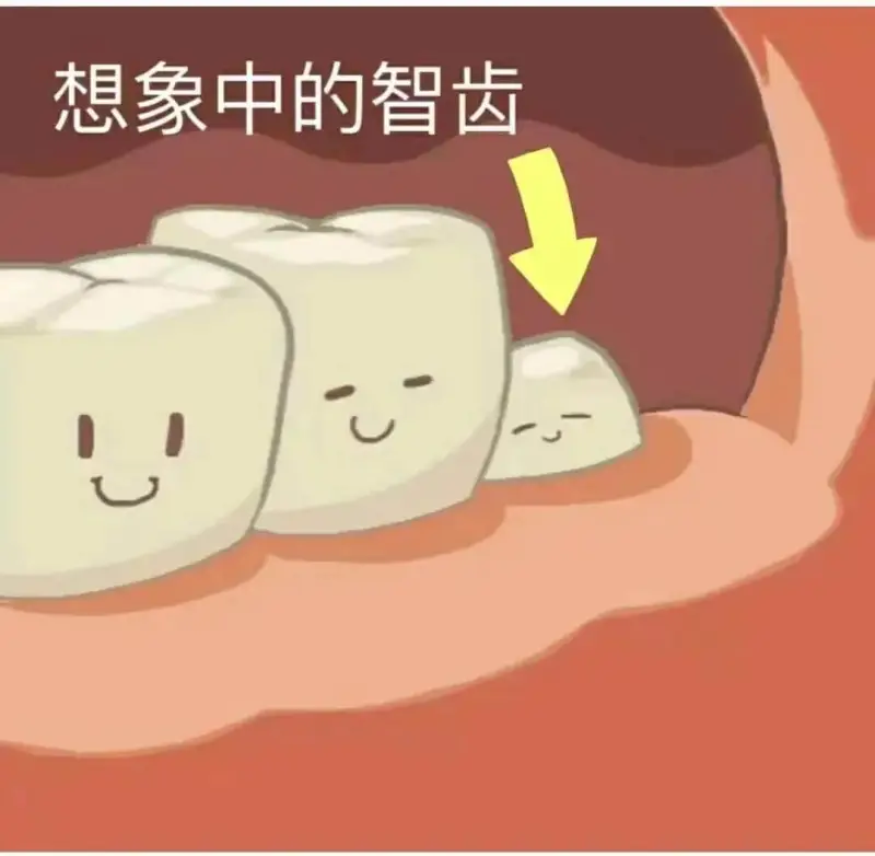想象中的智齿