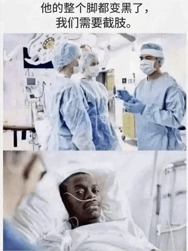他的整个脚都变黑了，我们需要截肢。