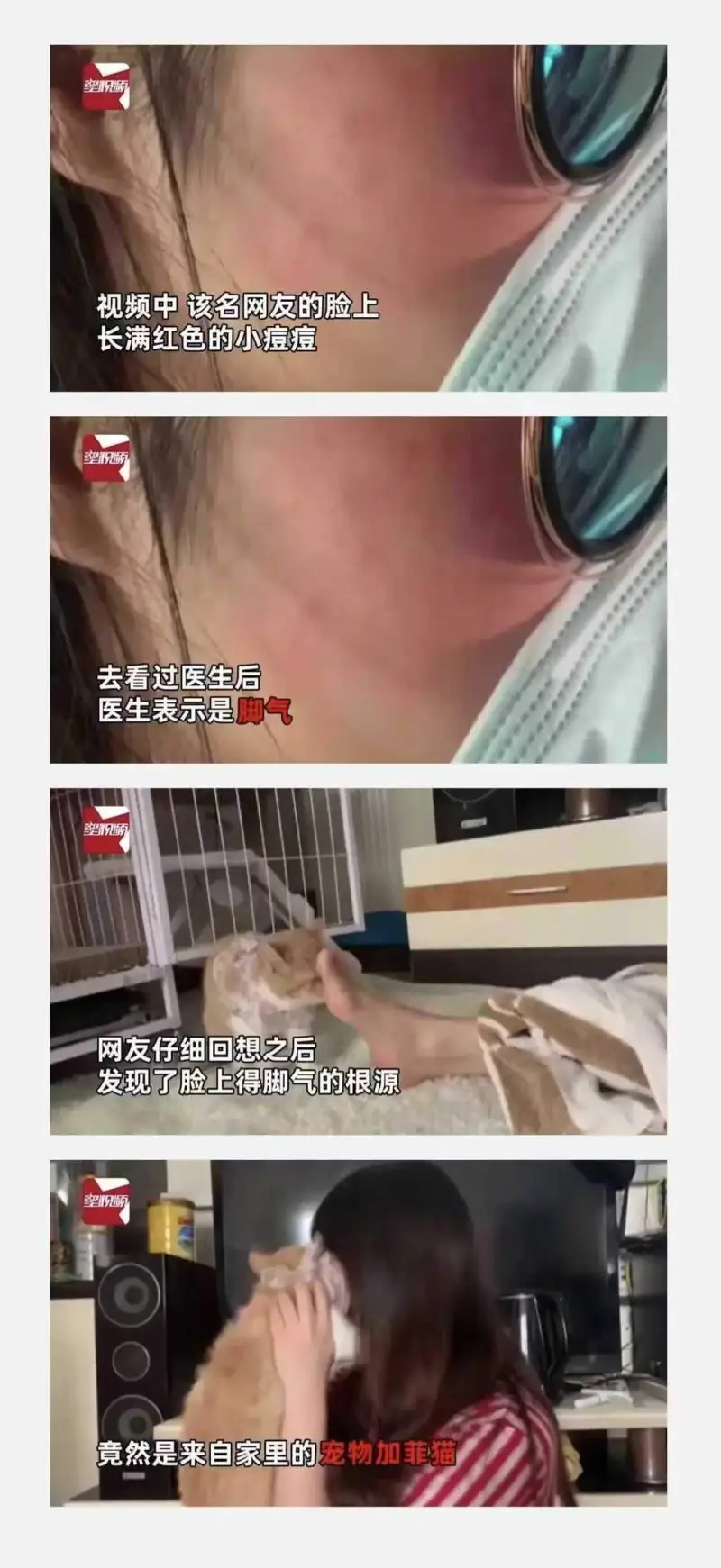 视频中该名网友的脸上长满红色的小痘痘。后来去看过医生后，医生